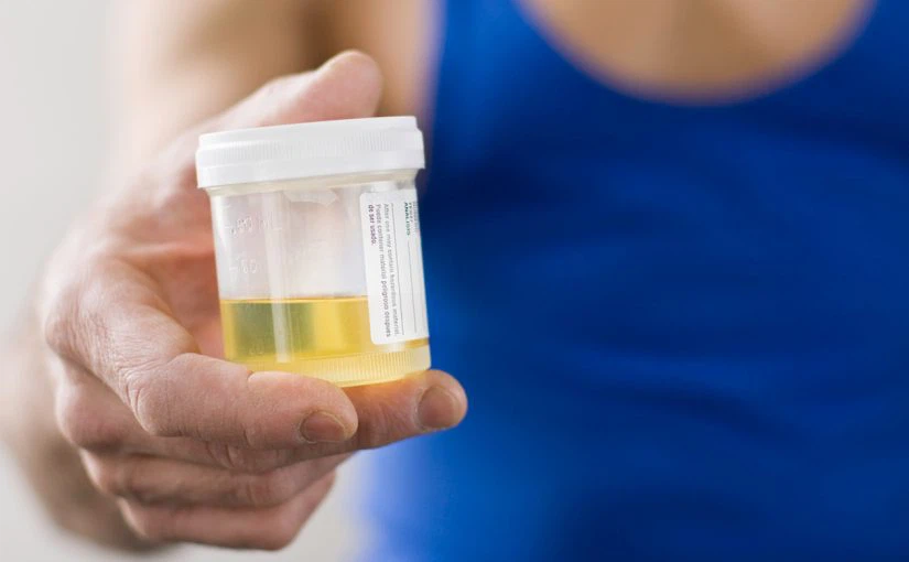 urine-sample-825x510
