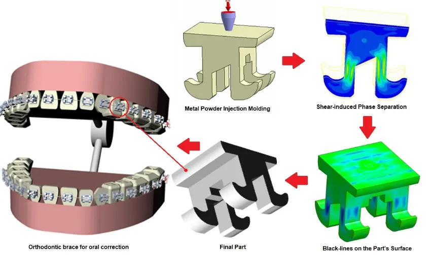 Orthodontic Brackets Orthodontic Brackets